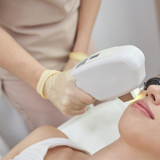 IPL Treatment