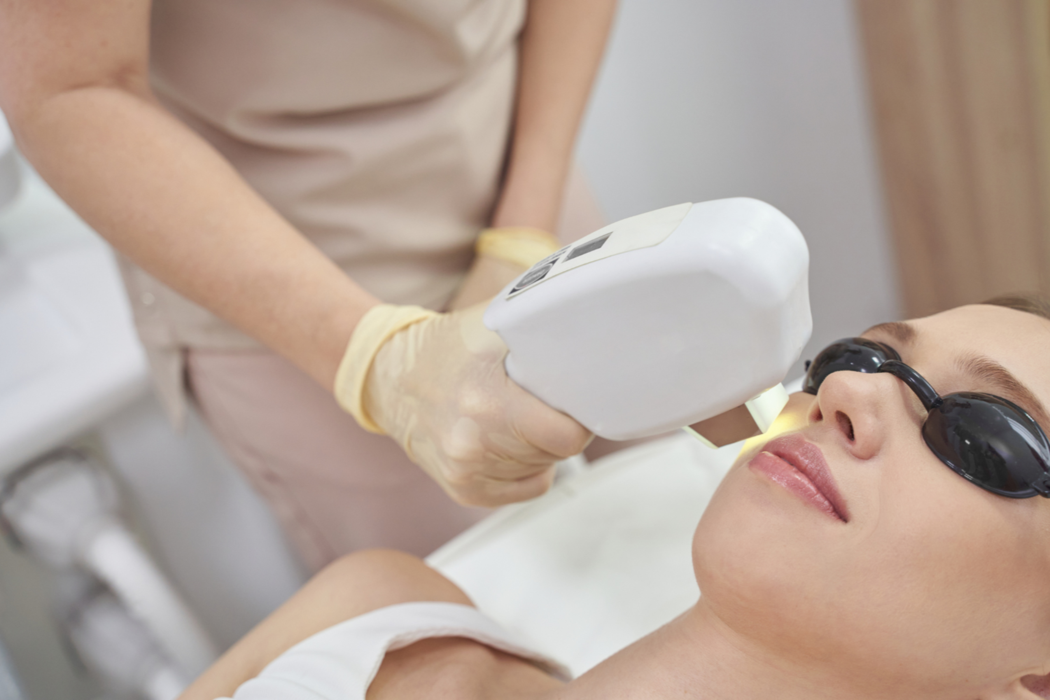 IPL Treatment