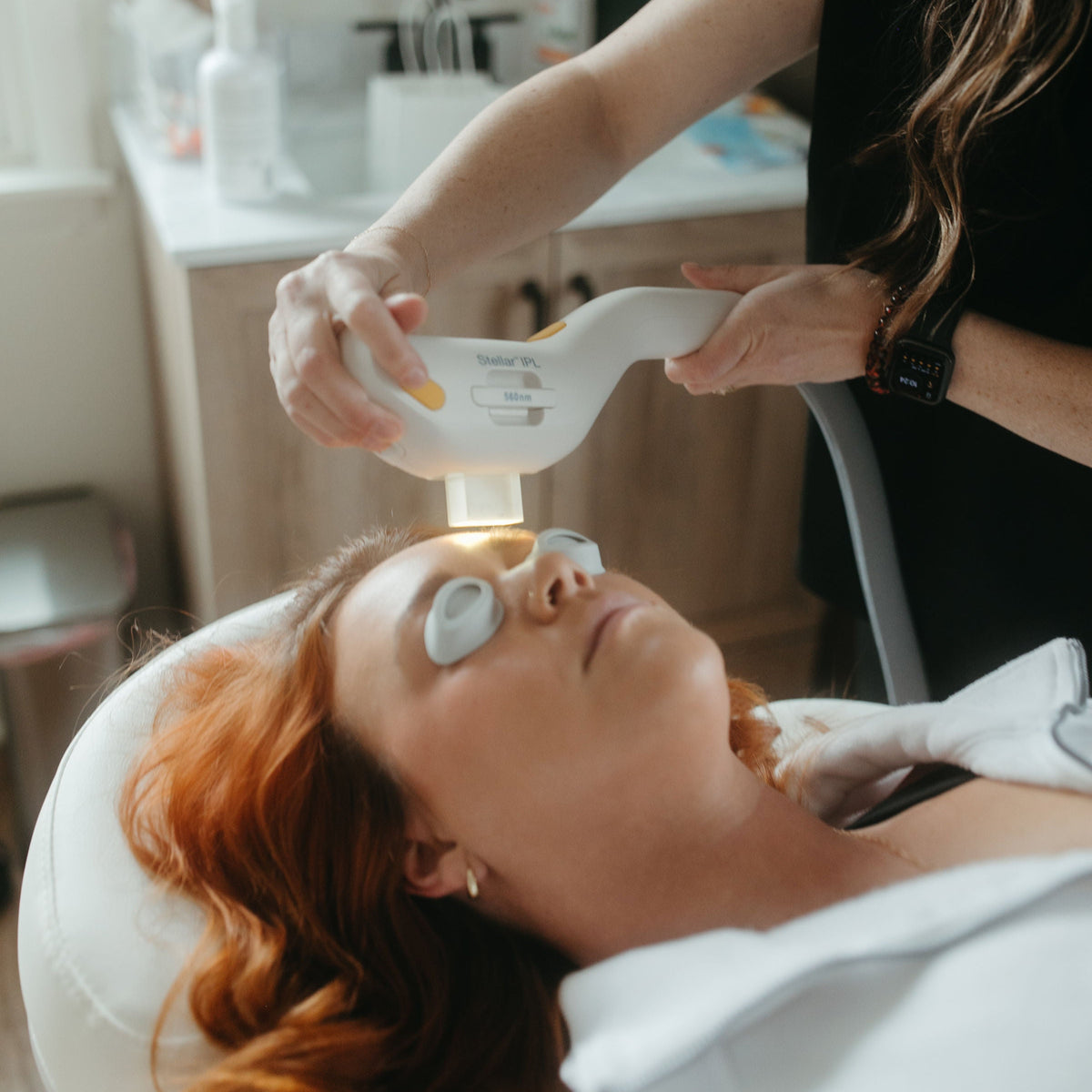 Face IPL service for Nuud Skin Co